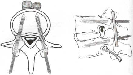 Stabiliyacija